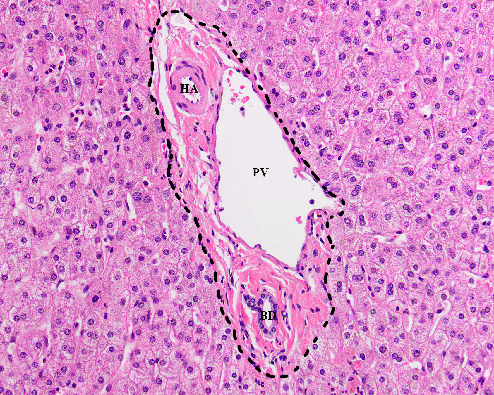Histology Liver Portal Triad Microscopic Cells Histol - vrogue.co